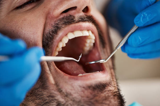 Best Emergency Broken Tooth Repair in Vivian, LA