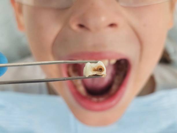 Best Pediatric Emergency Dentist in Vivian, LA