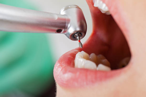 Best Weekend Emergency Dentist in Vivian, LA